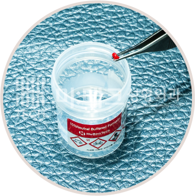 수술 후 조직 채취