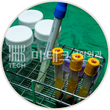 안전하게 조직 보관