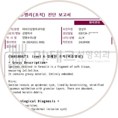 조직 검사 결과 수신