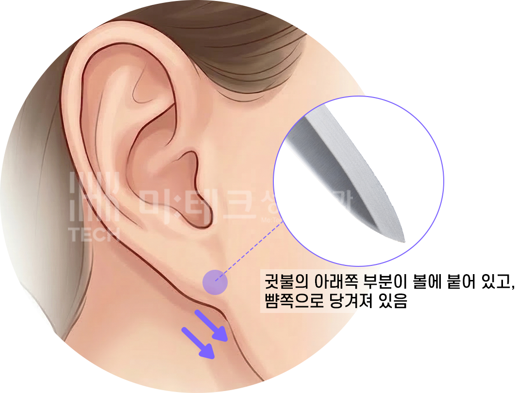 칼귀