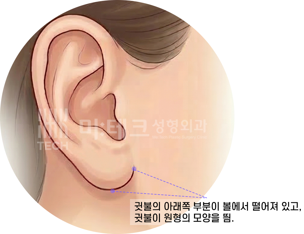 정상귀