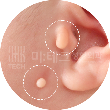 여러 곳에 생긴 스킨텍